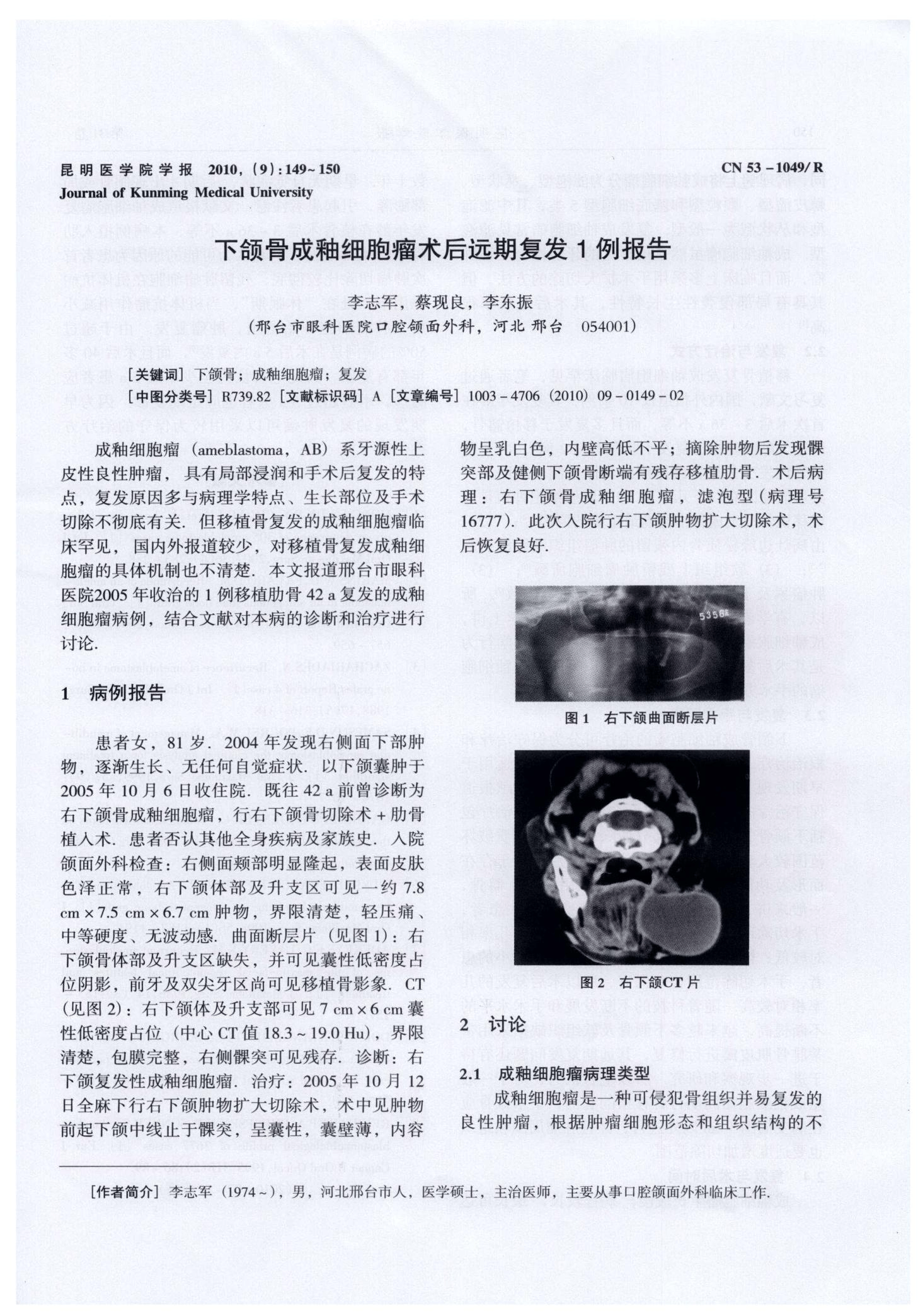 成都东部新区中西医结合医院成功实施下颌骨骨折切开复位内固定术