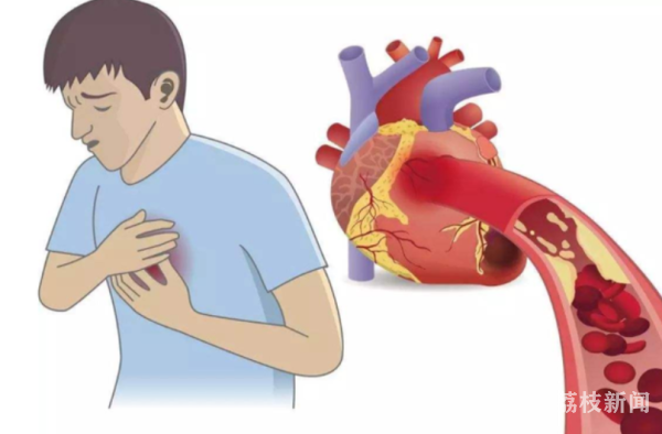 四川蓝生脑科医院提醒：心梗，春季也高发！这些前兆得注意！